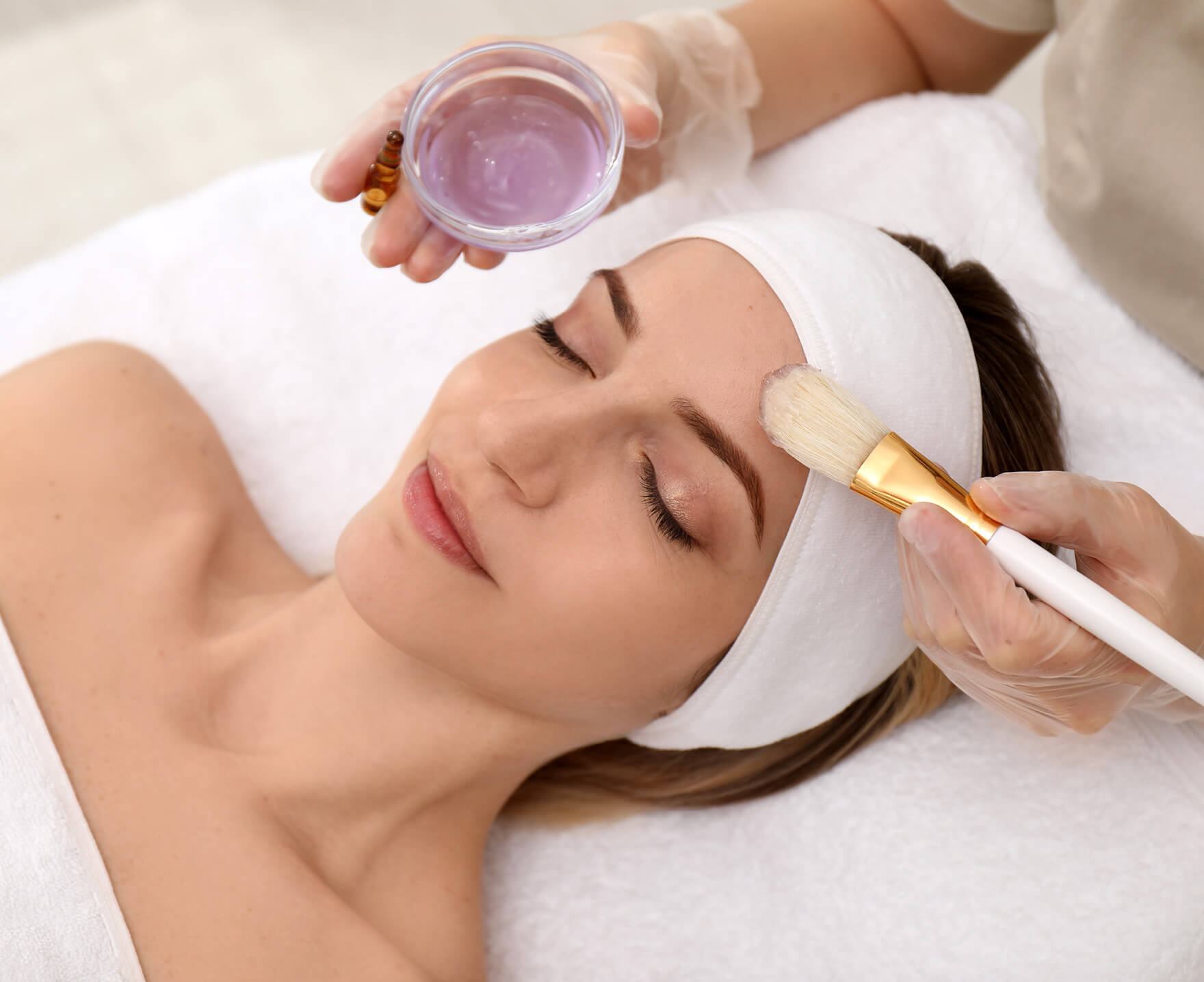 Mississauga Streetsville spa chemical peels