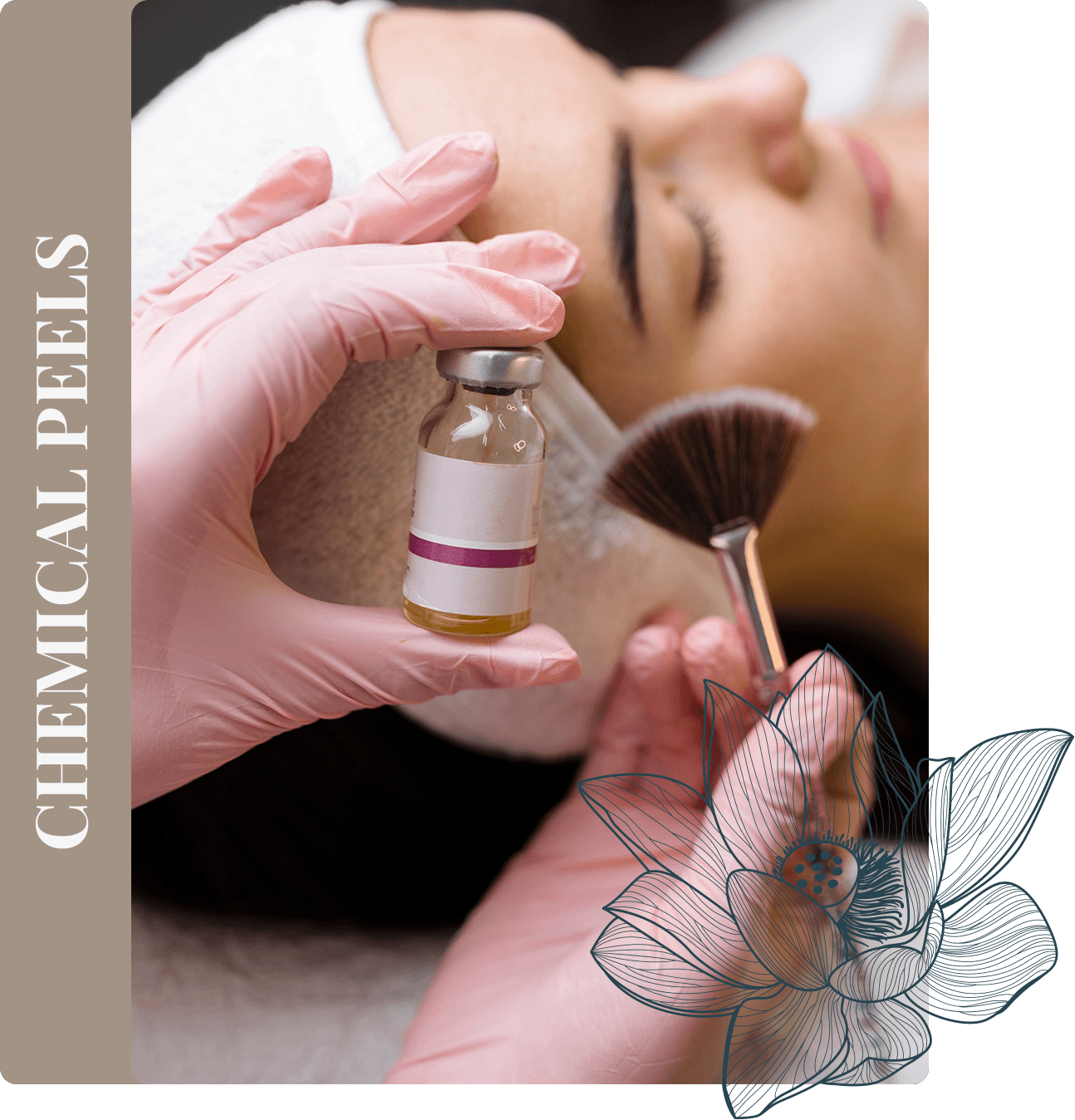chemical peels in escape at the spa