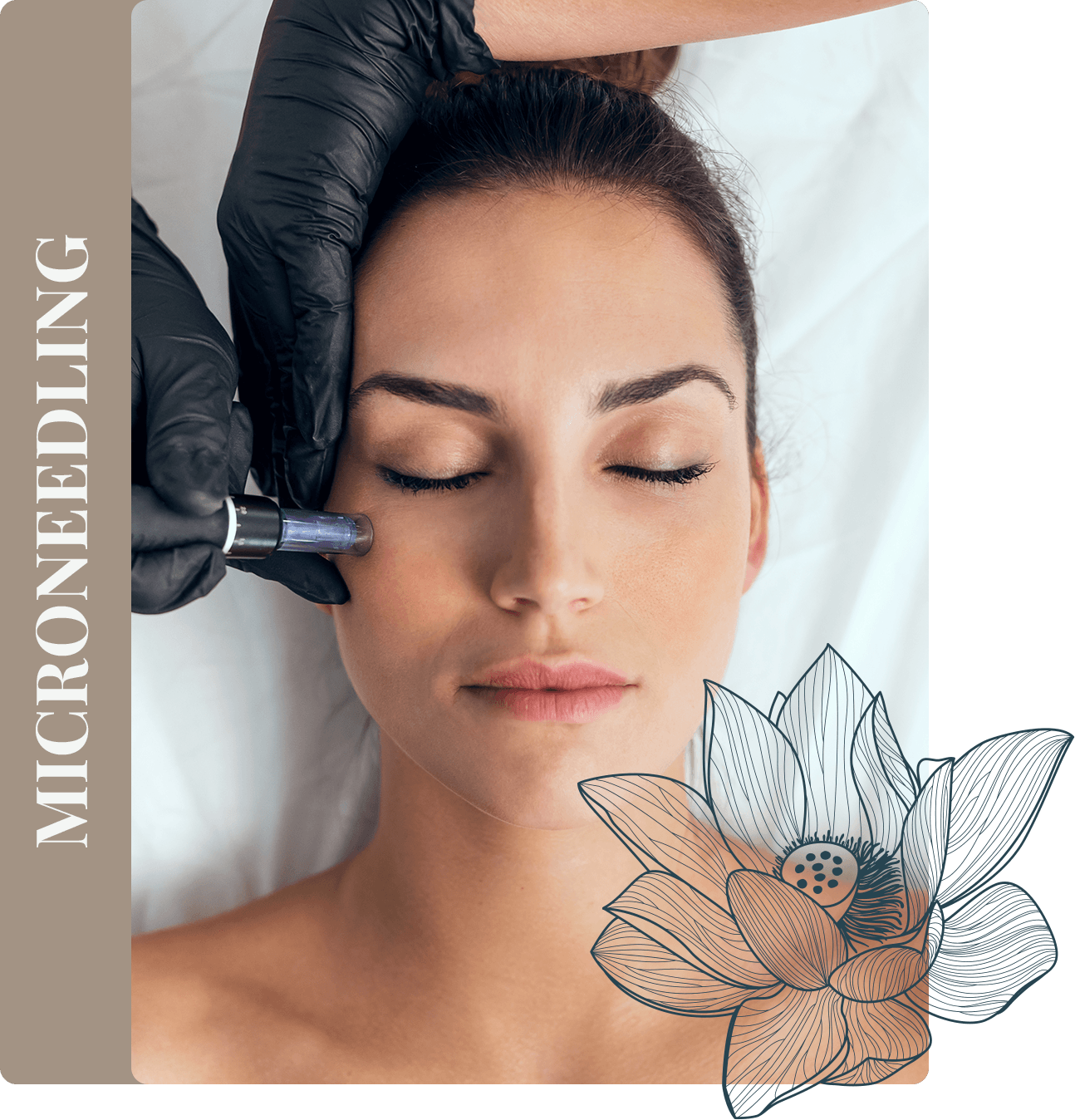 microneedling in escape at the spa